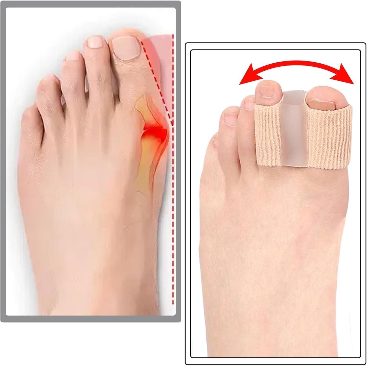 Toe Separator for Women & Men (Pack of 1)